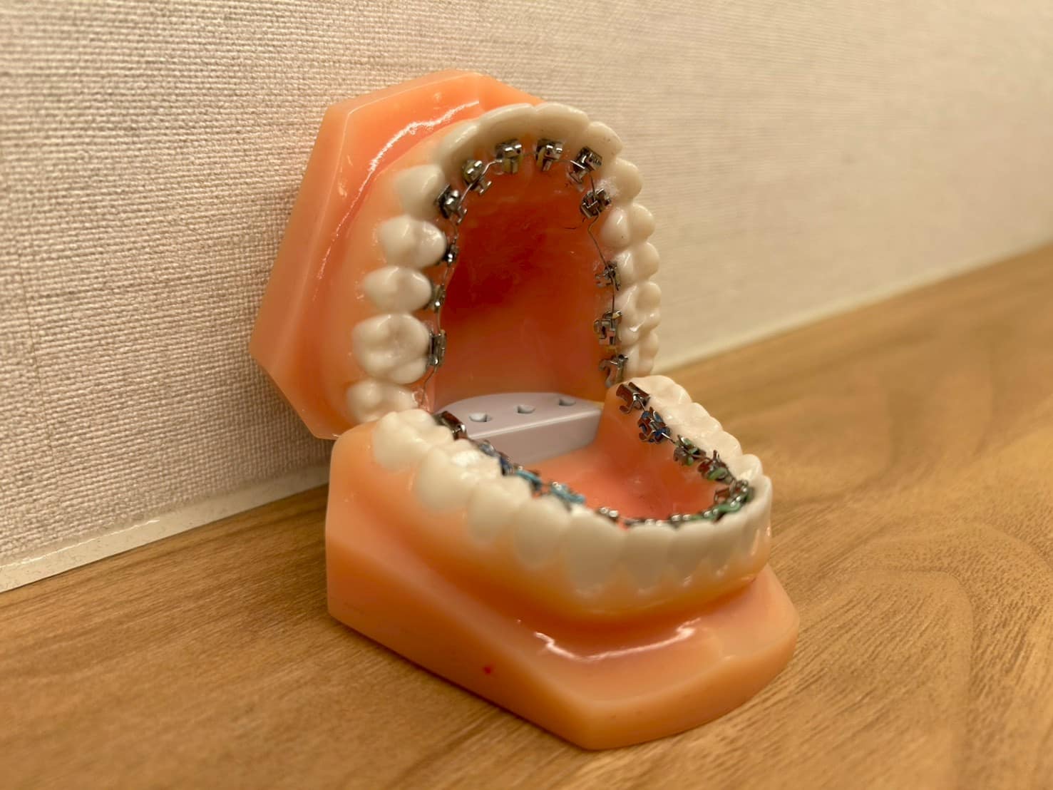 ブラケット矯正の模型